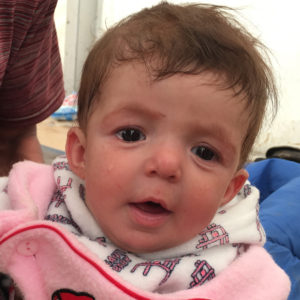 Marwa*, 5 months, at Hamam al-Alil IDP camp in Iraq. Marwa*s mother Ashna* and her father Salar* fled fighting in Mosul with their six young children, including Marwa*. Marwa* said: "The journey was hard and me and the children were very scared. But all I could think about was how we needed to get to safety and how I needed to keep my children safe – so that drove me and kept me going even though the children were very hungry and they were crying a lot. My older children were able to walk but we had to carry the younger ones in our arms – I carried Marwa*, while my husband carried my son and my uncle my other daughter. Marwa* is sick. Ten days ago she got a high fever and bad diarrhea. We were given medicine but it is not working and then, about two days ago, she got a bad cough that is getting worse. Luckily she sleeps at night, but her diarrhea never stops. It is very difficult to deal with this here. There is no privacy at all. Neither me, nor the baby, have had a shower since we arrived 20 days ago and I have five other young children to look after. We all have to sleep on the floor in the tent with many other families. It is noisy and dirty."