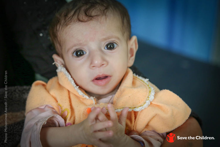 Cholera Epidemic in Yemen Threatens Puts Children at Risk
